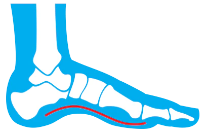 Currex - Foot Insoles Low - Medium - High Foot Arch - Clearance Item