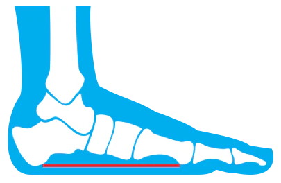 Currex - Foot Insoles Low - Medium - High Foot Arch - Clearance Item