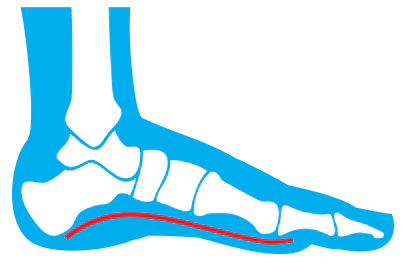 Currex - Foot Insoles Low - Medium - High Foot Arch - Clearance Item